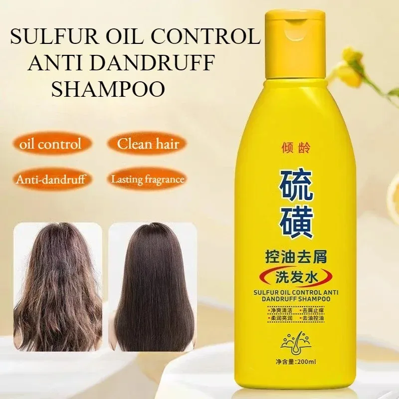 Purifying Sulfur Anti-Dandruff Shampoo 200ml - Control Flakes, Balance Scalp, and Regulate Oil for Smooth Hair