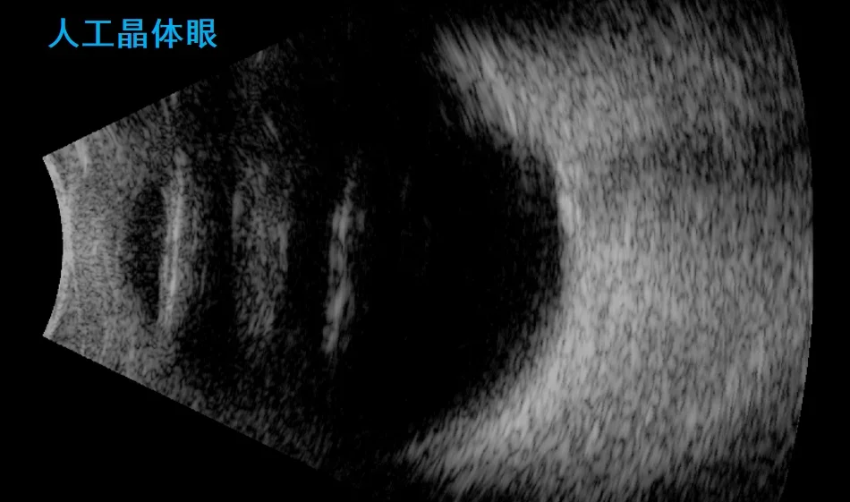 2025 Ophthalmic Scanner SK-3000A Ophthalmology Machine with AB Scan Ocular Ultrasound Instrument