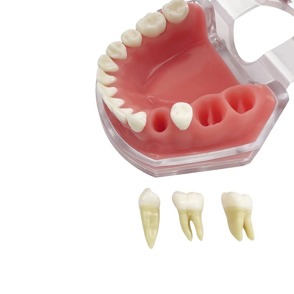 Thumbnail 3 - #34 Dental Teaching Models List of Top Picks
