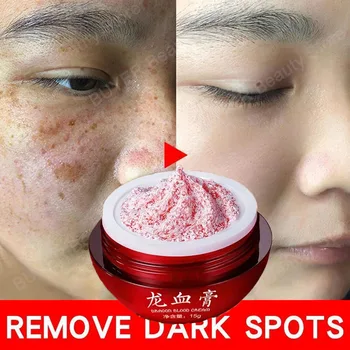 Drakenbloed Gezichtscrème Effectieve Whitening Sproet Verwijderen Melasma Crème Verwijderen Donkere Vlekken Melanine Huidverzorgingscosmetica 15G