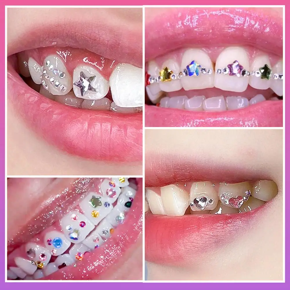 1set Zahn Edelstein Dekoration Dental Zähne Ornament Glas Diamant Geformt Ornament Diy Werkzeuge Party Verwenden Einfache Anwendung für anfänger