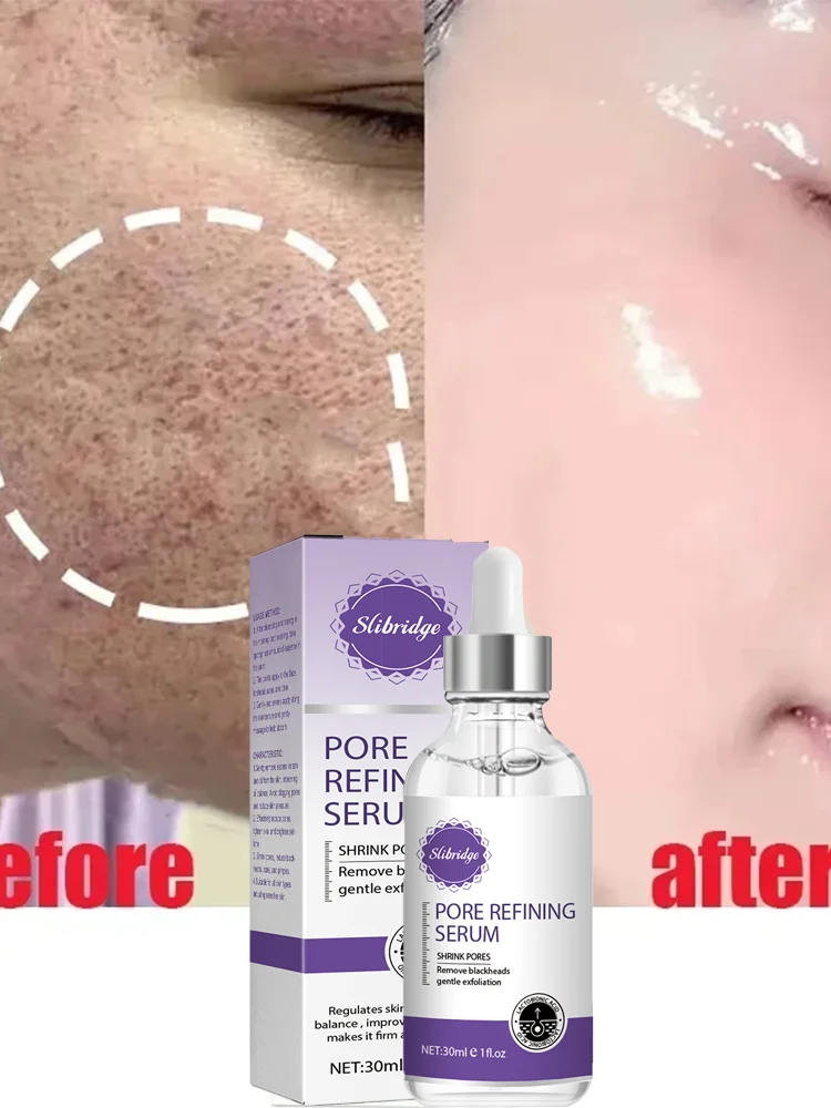 

Pore Shrinking reducing Whitening Moisturizing Serum