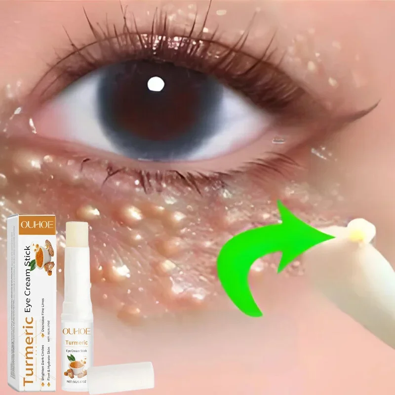 

Eye Fat Granules Removal Eyestick Anti-Puffiness Firming Cream Anti Inflammatory Fade Fine Line Repair Skin Barrier Skin Care