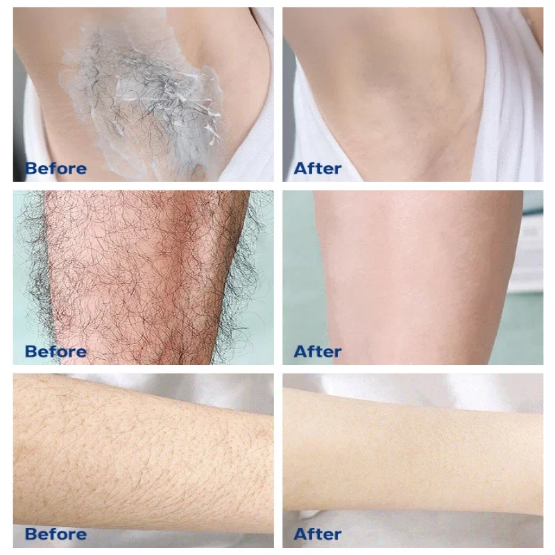 Fast Hair Removal Cream Painless Hair Growth Inhibitor Arm Armpit Legs Permanent Depilatory for Men Women Beauty Health Care 60g