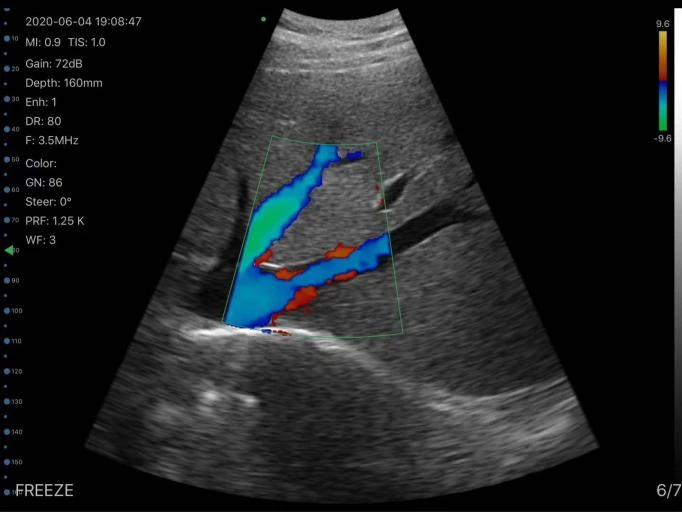 SY-A053C Dual portable wireless 3 in 1 ultrasound probe  for Abdomen Superficial  Lung Cardiac Mini Color Doppler Ultrasound