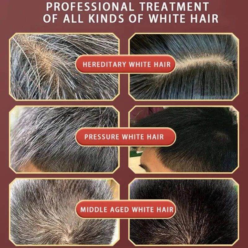 Suero de tratamiento para el cabello gris y blanco, reparación de Color Natural blanco a negro, tinte líquido para cubrir el cabello gris, antipérdida de cabello, nutre el cuidado del cabello