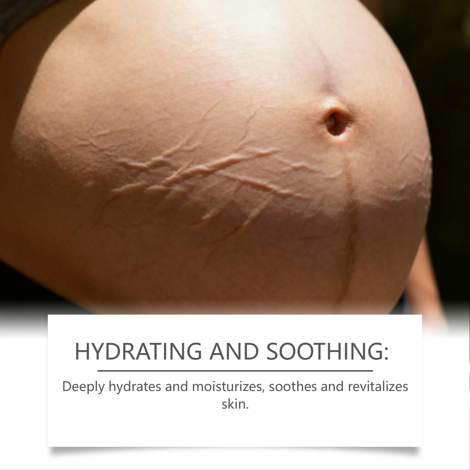 كريم علامة تمدد البطن للحمل لمرونة الكافيين ومرطب الجسم أرنيكا مهدئ للحكة العناية بالبشرة الجافة للأمهات