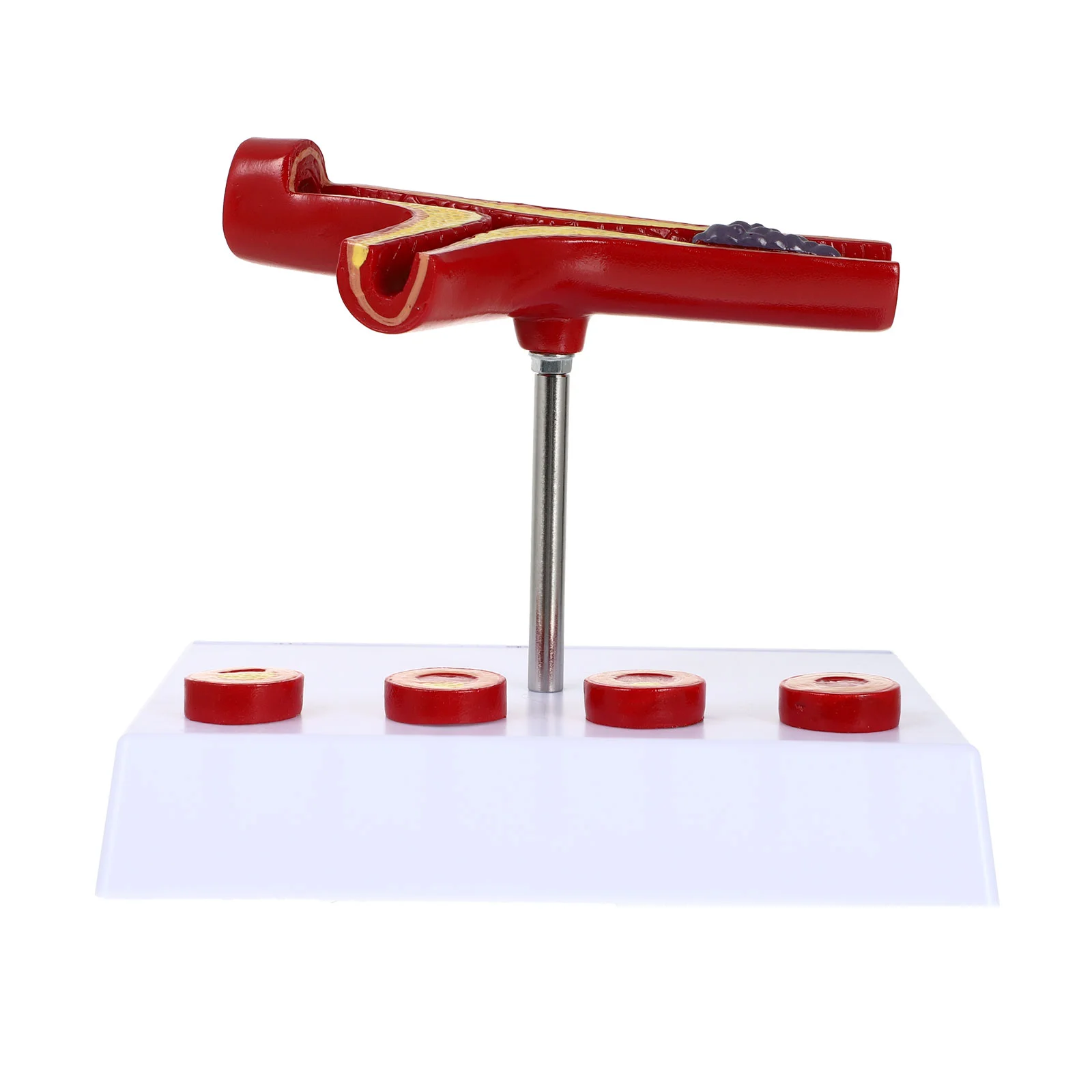 Vascular Model Atherosclerosis Display Human Anatomical Models Cardiovascular Teaching Vacuum