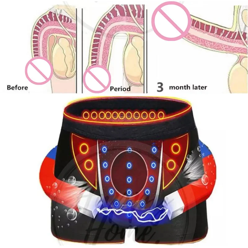 Men Boxers Sexy Lingerie Magnetic Underwear Energy Function Physical Therapy Briefs Health Care Underpant Enhance Gay Panties