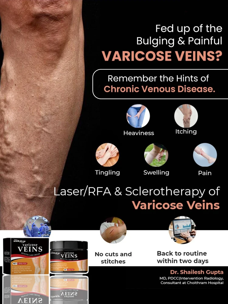 

2025 Hot sale Vein blue light tool, more discounts on sets Leg care tools say goodbye to varicose veins