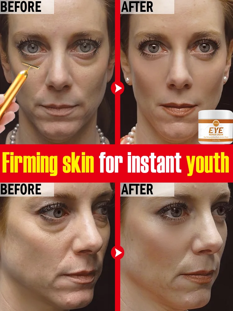 

Instant eye bag Removal Cream Collagen Anti-wrinkle firming and Fading fine line dark circles Korean cosmetics