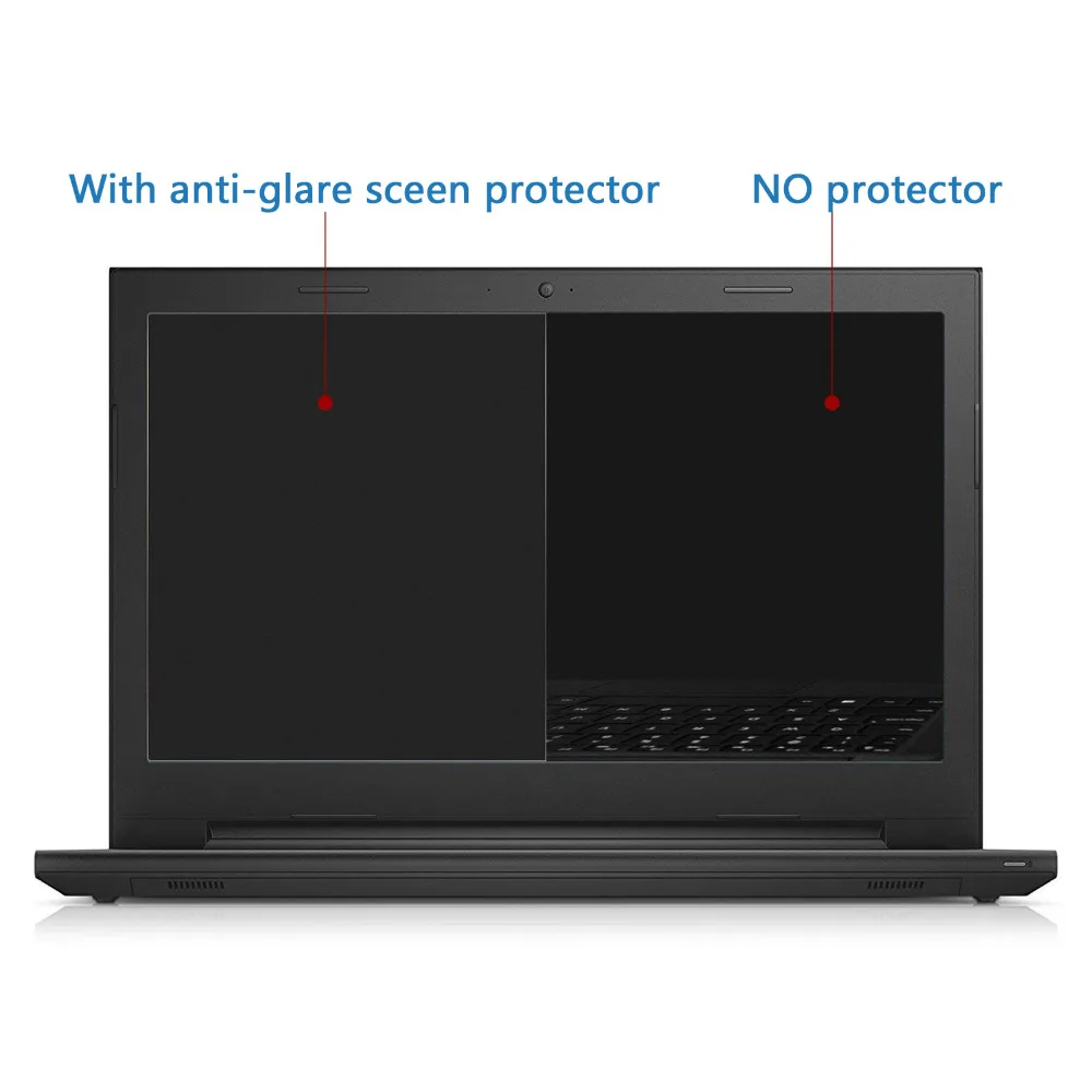 3pcs Matte Blu-ray Notebook Screen Film laptop for Apple MacBook
