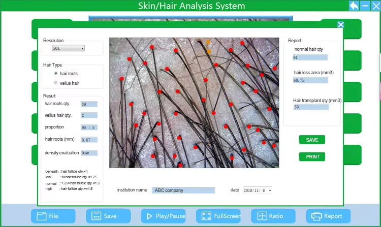 USB Electric Microscope 20X/200X Digital Microscope Camera For Scalp Facial Analyzer Skin Magnifier Supports Windows System