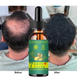 Effective Ginger Hair Growth Ointment Hair Care Healthy Anti-Hair Loss Essence Oil Damaged Hair Nutrition Cream