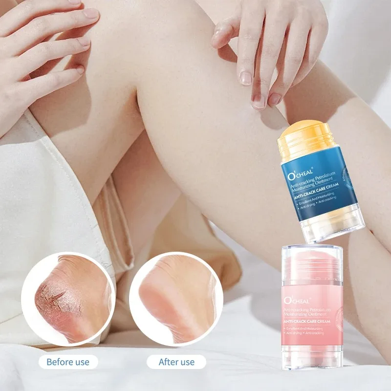 

Anti Crack Foot Cream For Dry And Cracked Feet And Heels, Moisturizing Dry Feet And Heels, Preventing Your Feet From Cracking