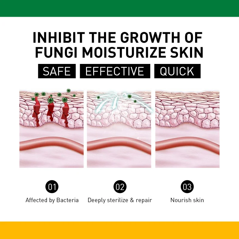 Les gommes et les capsules molles pour femmes nourrissent, hydrate, protège le teint, améliore la peau et soulage la décoloration sur le front