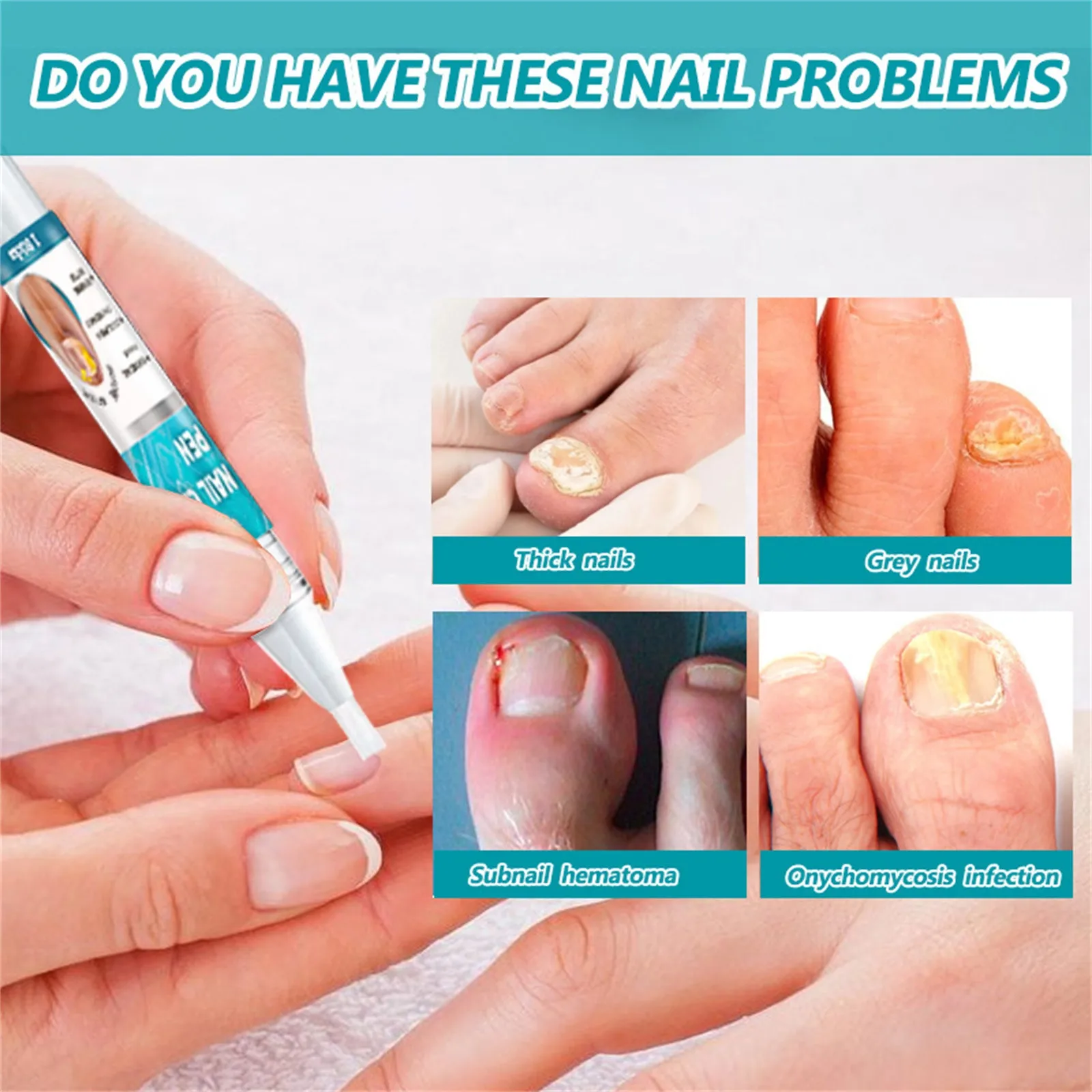 Toenail Fungus Care, FastActing Nail Care Liquid For Fungus Under & Around Restores The Healthy Appearance Of Nails 5ml