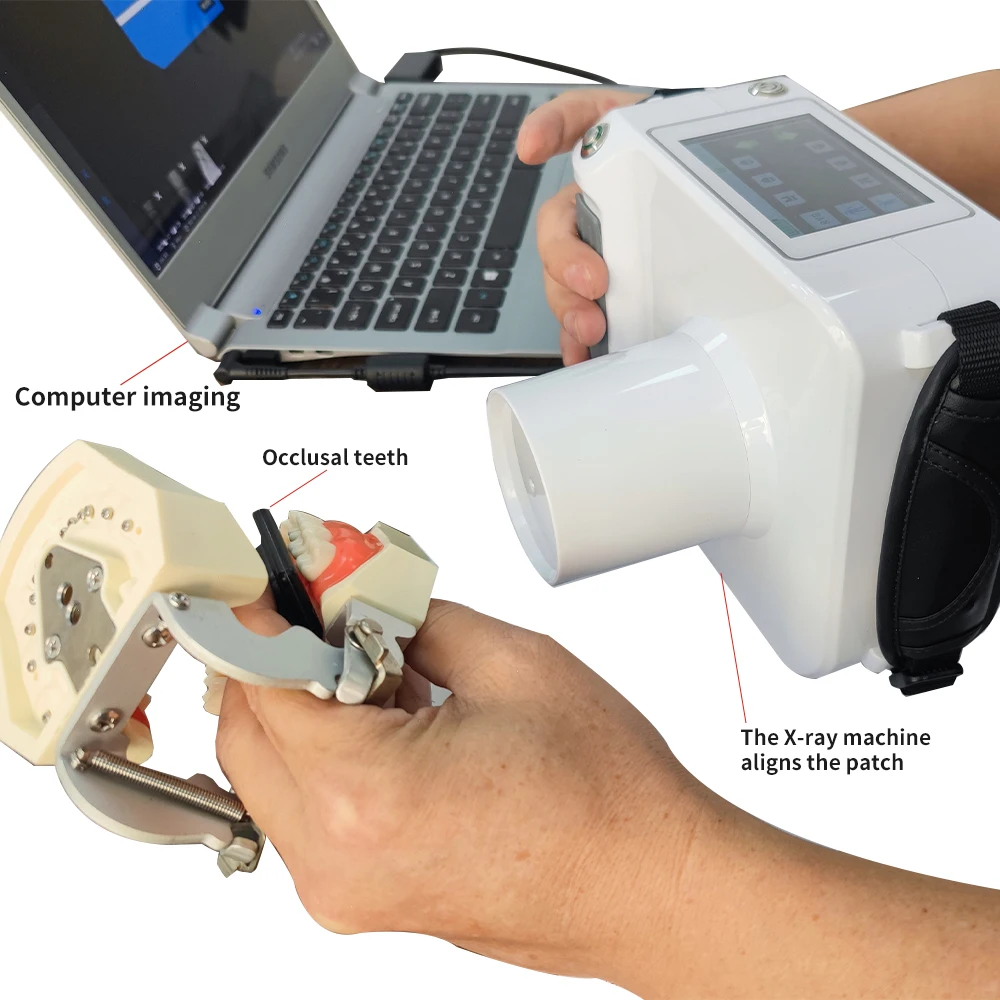 

Portable Dental X Ray Camera Frequency Imaging System X-Ray Machine Digital RVG Sensor for Dental/clinics/hospitals Human Vet