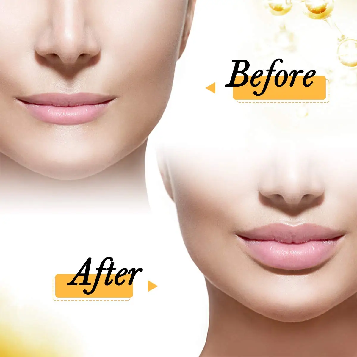 0.3ml Hyaluronic Pen Injection Gun For Anti Wrinkle Lifting Lip Anti-wrinkle Skin Rejuvenation Hyaluron Pen