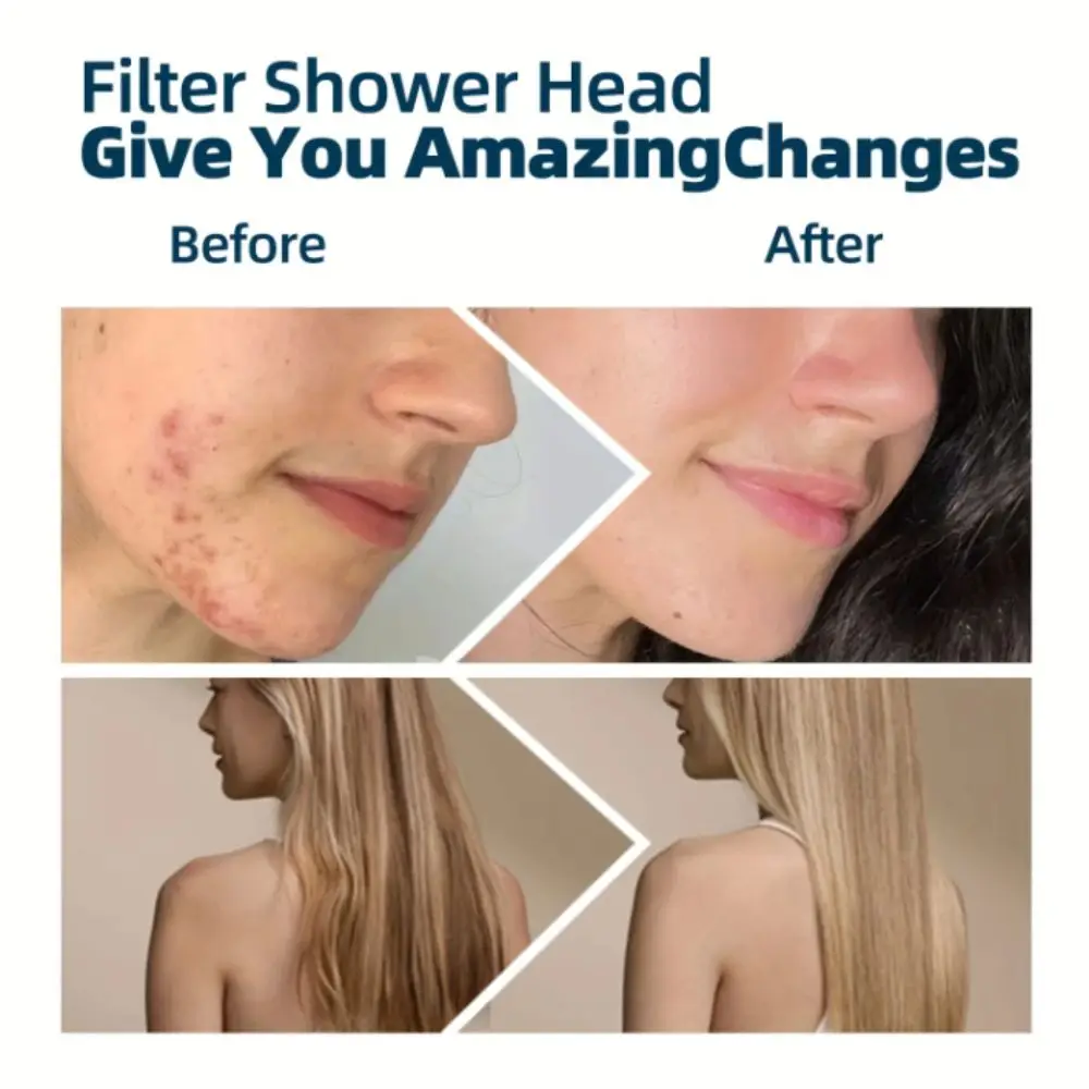 

360° Adjustable Shower Water Purification Filter Reduce Skin Dryness Adjustable Nozzle Shower Head Filter