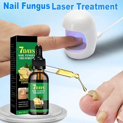 Nagel Schimmel Laser Behandeling Teennagel Reparatie Vingernagel Apparaat Nagels Behandeling Voet Nagel Schimmel Etherische Olie Onychomycosis Zorg