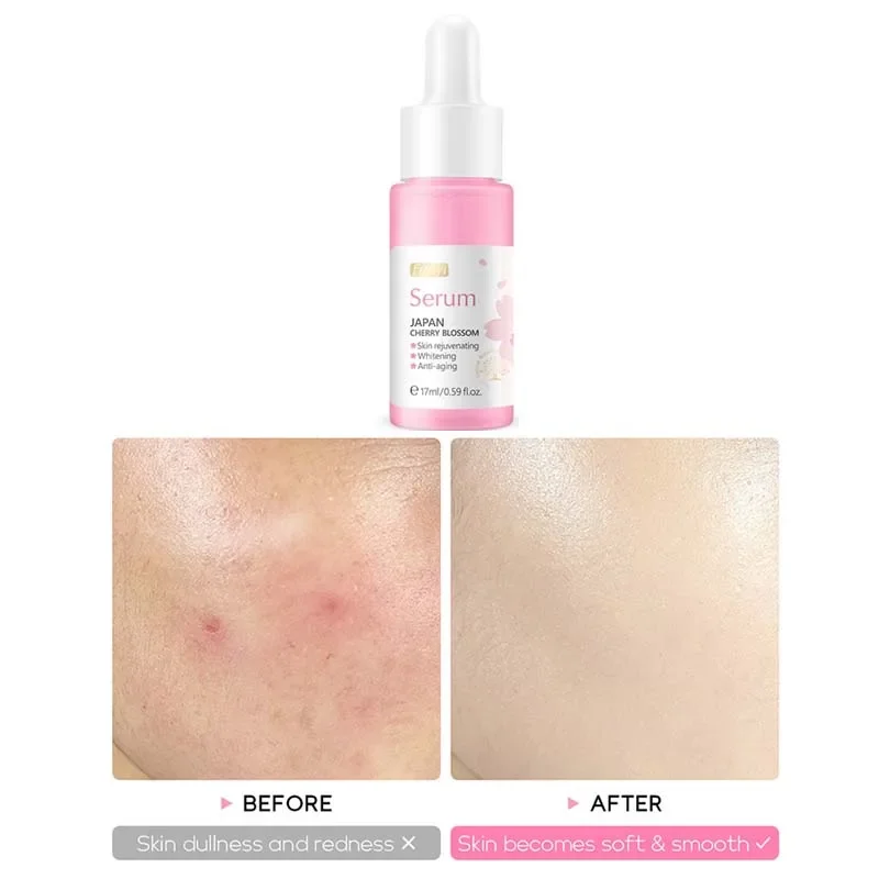 17ML Serum Japan Sakura Essence Balance Grease Anti-Aging Hyaluronic Acid Pure Whitening Rejuvenation Skin Care Face Serum