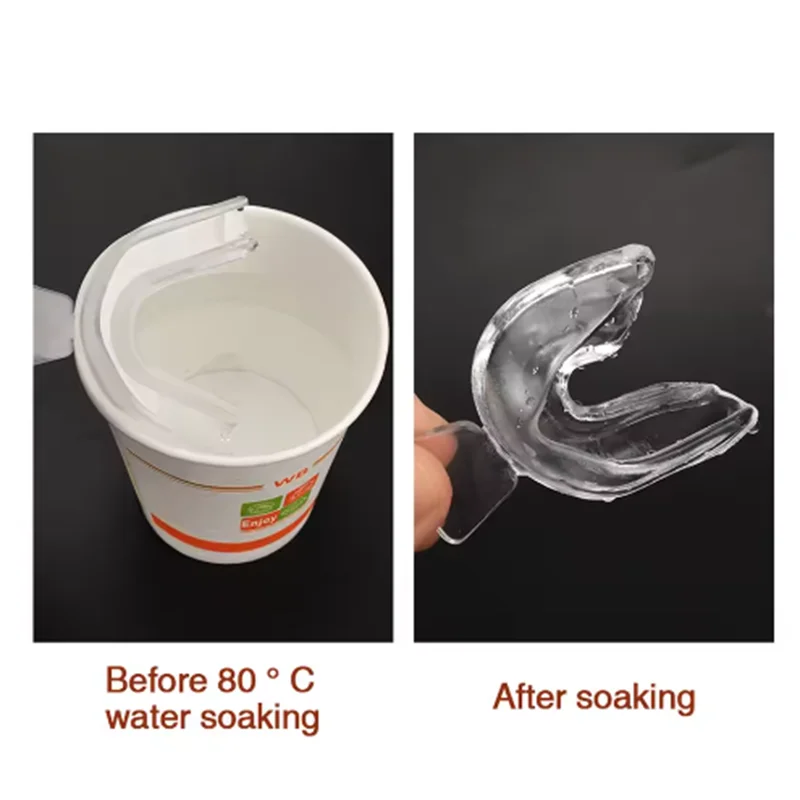 4 قطعة حامي الفم إيفا الأسنان حامي ليلة الحرس تقويم الأسنان الأقواس مجموعة حامي الفم حامي الأسنان صواني تبييض الأسنان #5