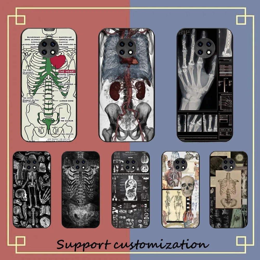 Radiological human organs Skeleton skull Phone Case For Redmi Note 4 X 5 A 6 7 8 T 9 9S 10 11 11S 11Epro Poco M3 pro