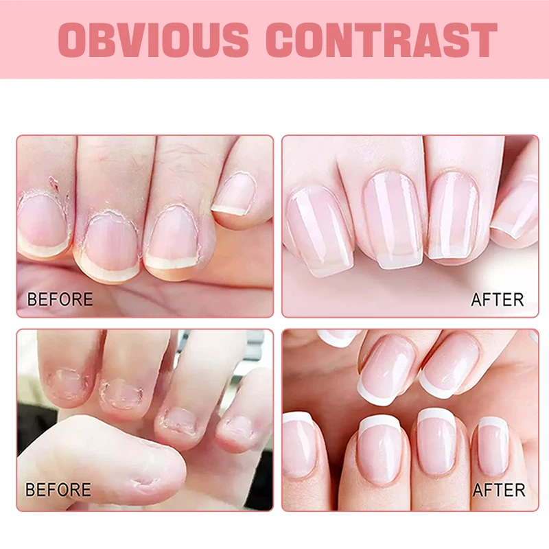 Honey/Rose/Vitamin E Nail Cuticle Nutrient Oil Nourishes Repairs Damaged Nails Moisturizing Strengthens Brightens Nail Care