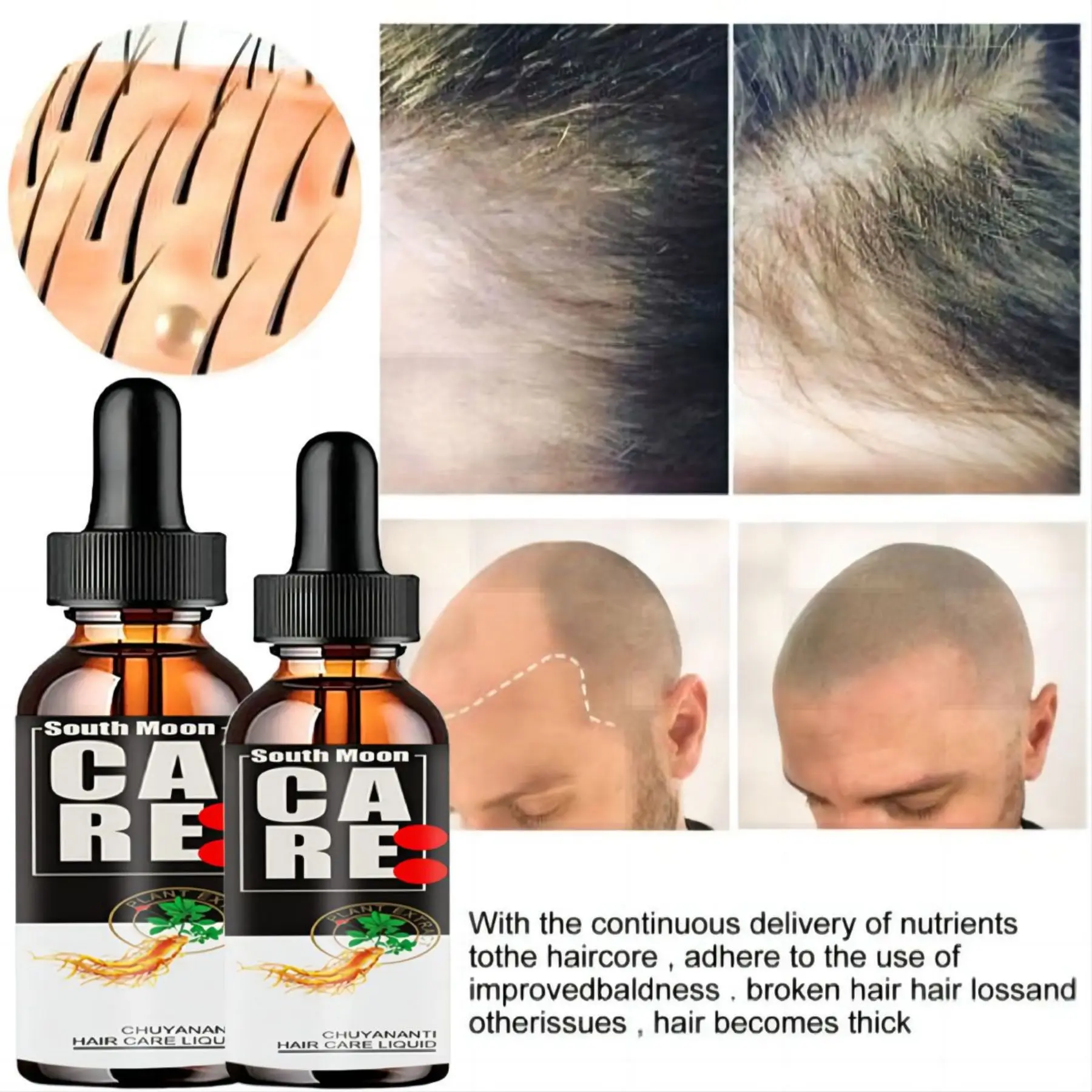 Hair Growth Conditioner Essential Oil Nourishing Hair Root Scalp Fast Growth Hair Serum