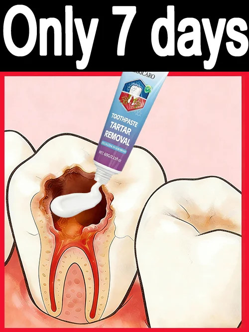 

Sᴄɪᴇɴᴛɪғɪᴄᴀʟʟʏ ᴘʀᴇᴠᴇɴᴛ ᴛᴏᴏᴛʜ ᴅᴇᴄᴀʏ, ᴄʟᴇᴀʀ ᴘʟᴀᴏ̨ᴜᴇ, ᴀɴᴅ ᴡʜɪᴛᴇɴ ʏᴏᴜʀ ᴛᴇᴇᴛʜ.Make your smile more confident