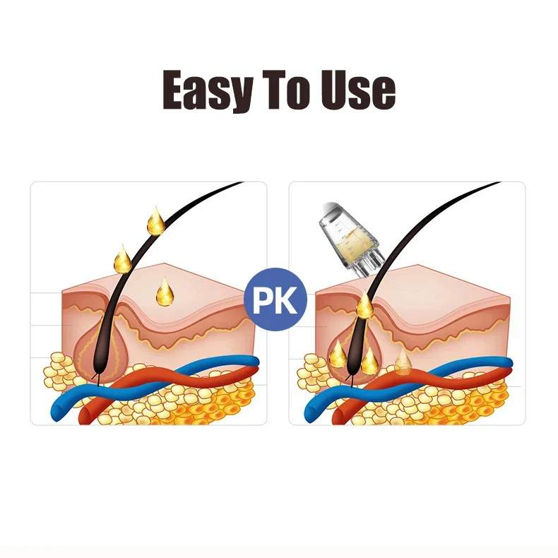 Аппликатор для кожи головы, жидкая расческа для массажа корней волос, сыворотка для роста волос, жидкая питательная направляющая жидкость, против выпадения волос, уход за кожей головы