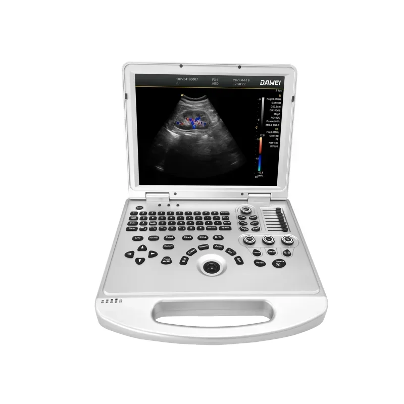 private clinic use laptop vascular, MSK, Cardiac ultrasound machine