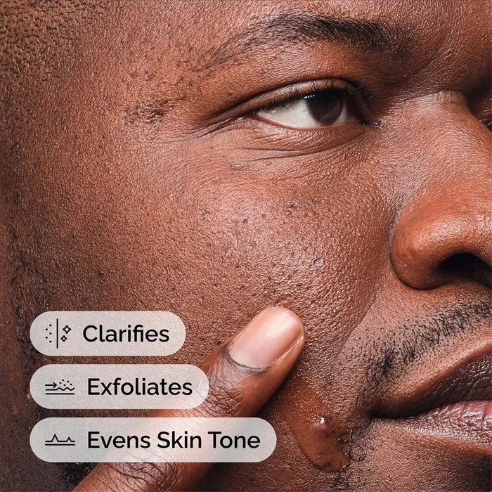 Salicylic Acid 2% Anhydrous Solution 30ml Remove Dirt Impurities Skin Surface Exfoliating Effect Minimise Appearance of Pores