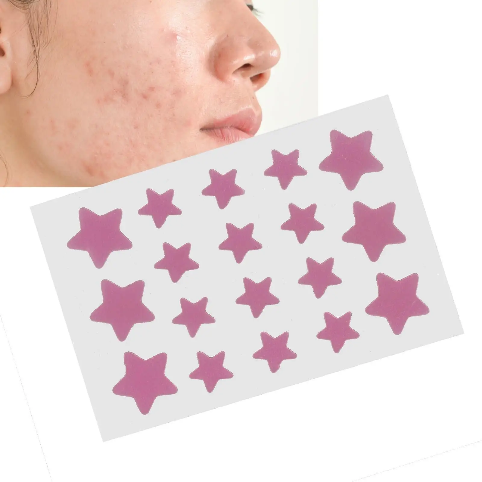 Patch idrocolloidale per brufoli da 18 fogli - Trattamento correttore per l'acne a forma di stella/forma impermeabile