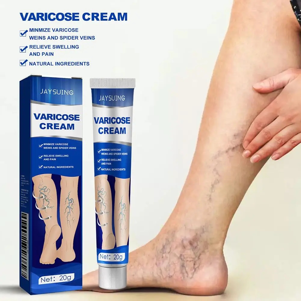ointment for varicose veins Effective varicose vein relief cream to relieve Leg vasculitis phlebitis spider pain treatment K4Z1