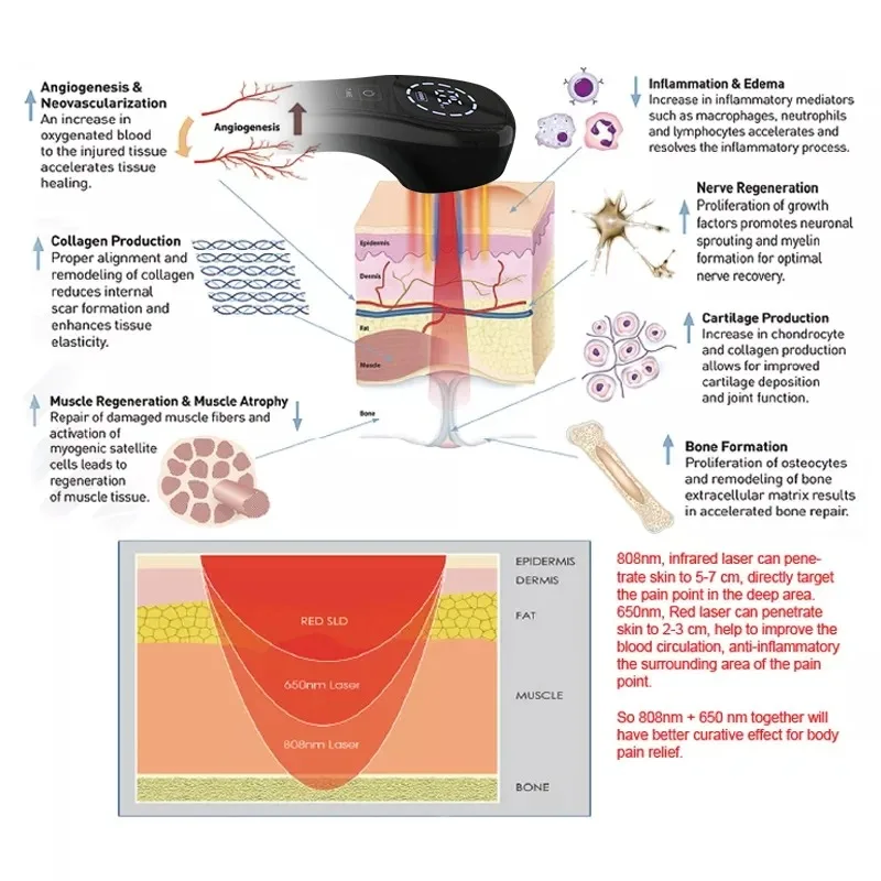 2x808nm, 12x650nm Handheld Laser Therapy Device, Used for Relieving Pain in the Body, Joints, and Muscles, Wound Healing