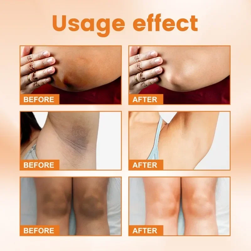 VitaminC Brighten Cream Melanin Remover Bleaching Armpits Elbows Knees Moisturizing Lightening Body Lotion Cream Skin Care New