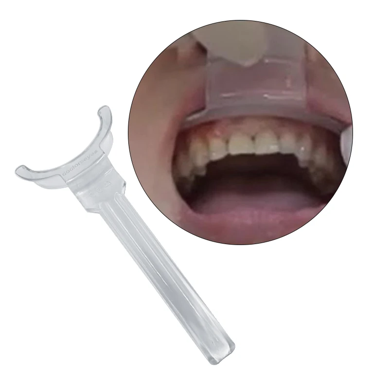 Retractor de labios superior e inferior, Retractor de labios de doble cabeza, abridor de boca de mejilla Intraoral, herramientas dentales de