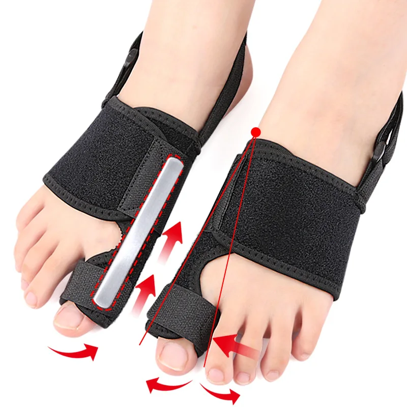 Hallux Valgus Bunion-Korrektor, Orthopädische Zehentrenner, Fußknochen-Adjuster, Daumen-Geradehalter, Schmerzlinderung, Pediküre-Fußpflege-Tool