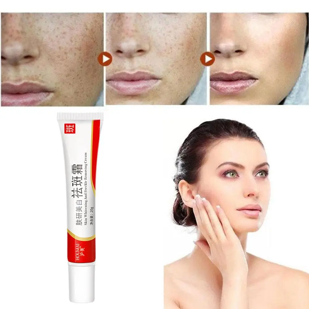 20g Whitening Freckle Cream Remove Dark Spots Anti Creams Face Care Pigmentation Brighten Skin Niacinamide Freckle Fade Mel Y2c9