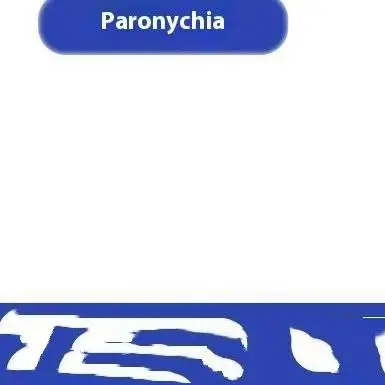 قطعتان من واقيات أصابع القدم المصنوعة من السيليكون الناعم، تقلل الاحتكاك وتمنع إدخال الأظافر للعناية بالجروح والعدوى الجنسية