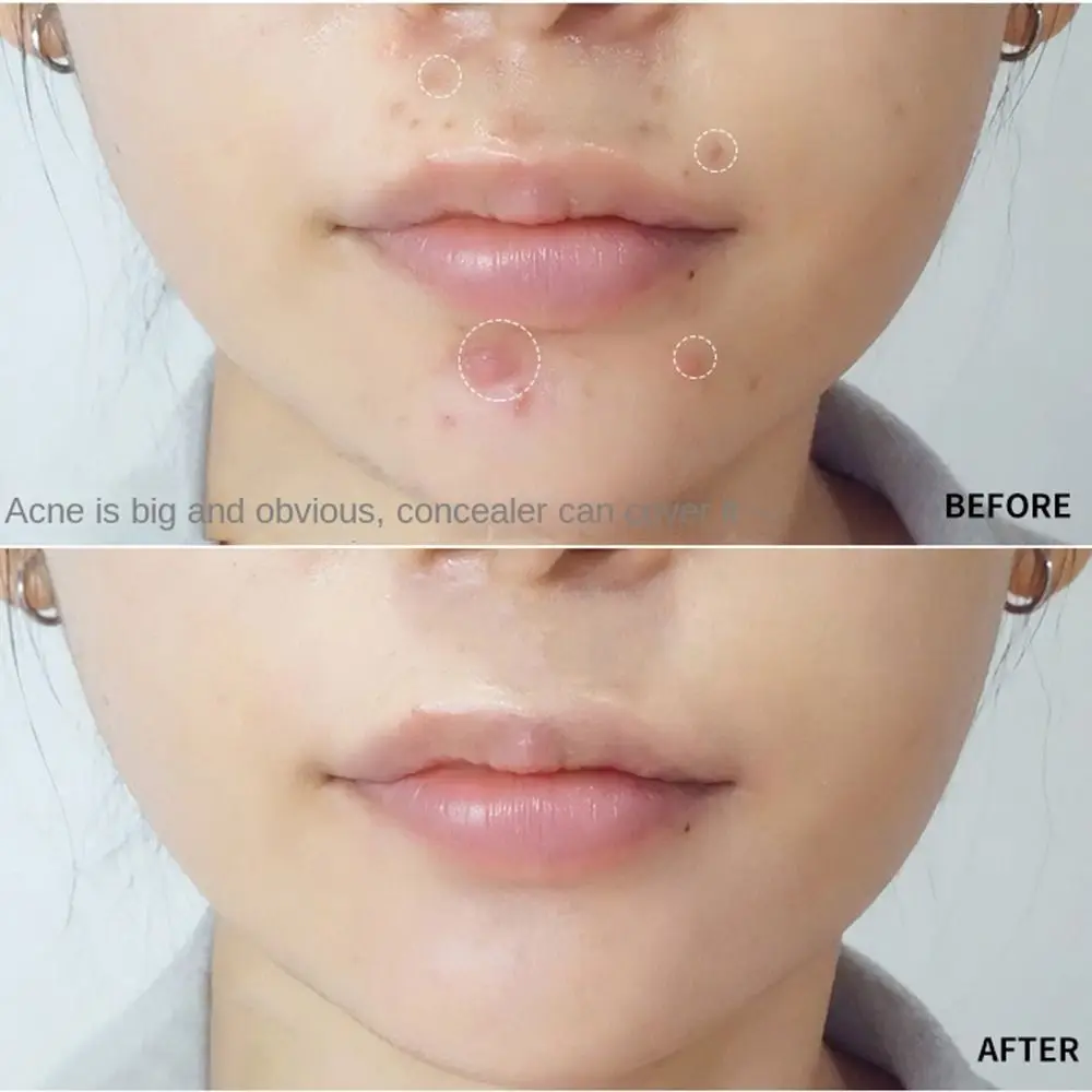 Acne Markeringen Bedekken Vlekken Hydrateren Donkere Kringen Concealer Volledige Dekking Crème Concealer Foundation Crème Vloeibare Foundation Foundation