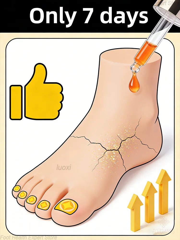 

Не раздражает окружающую кожу. При лечении онихомикоза оно питает ногтевую пластину, укрепляет и делает ногти более гибкими.
