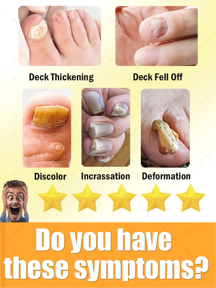 Blue laser care manicure