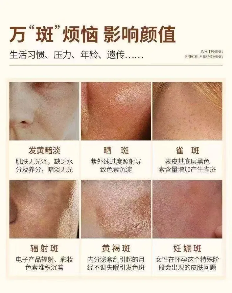 Body Brightening Cream Mask - Hydrating Nourishing Treatment for Skin, Elbow Knee Dark Spot Fader, Even Tone Glow Up Body Care
