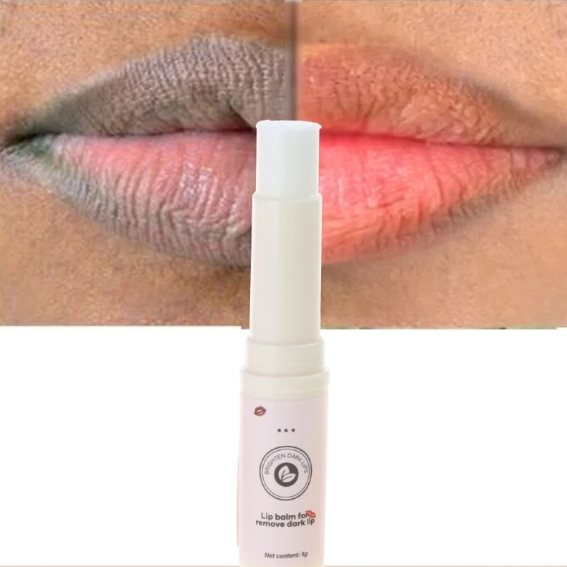 Lip Verzorging Lippen Roze voor Lightening Bleken Crème Behandeling Verwijderen Donkere Lippen Doffe Lippen Lip Lip
