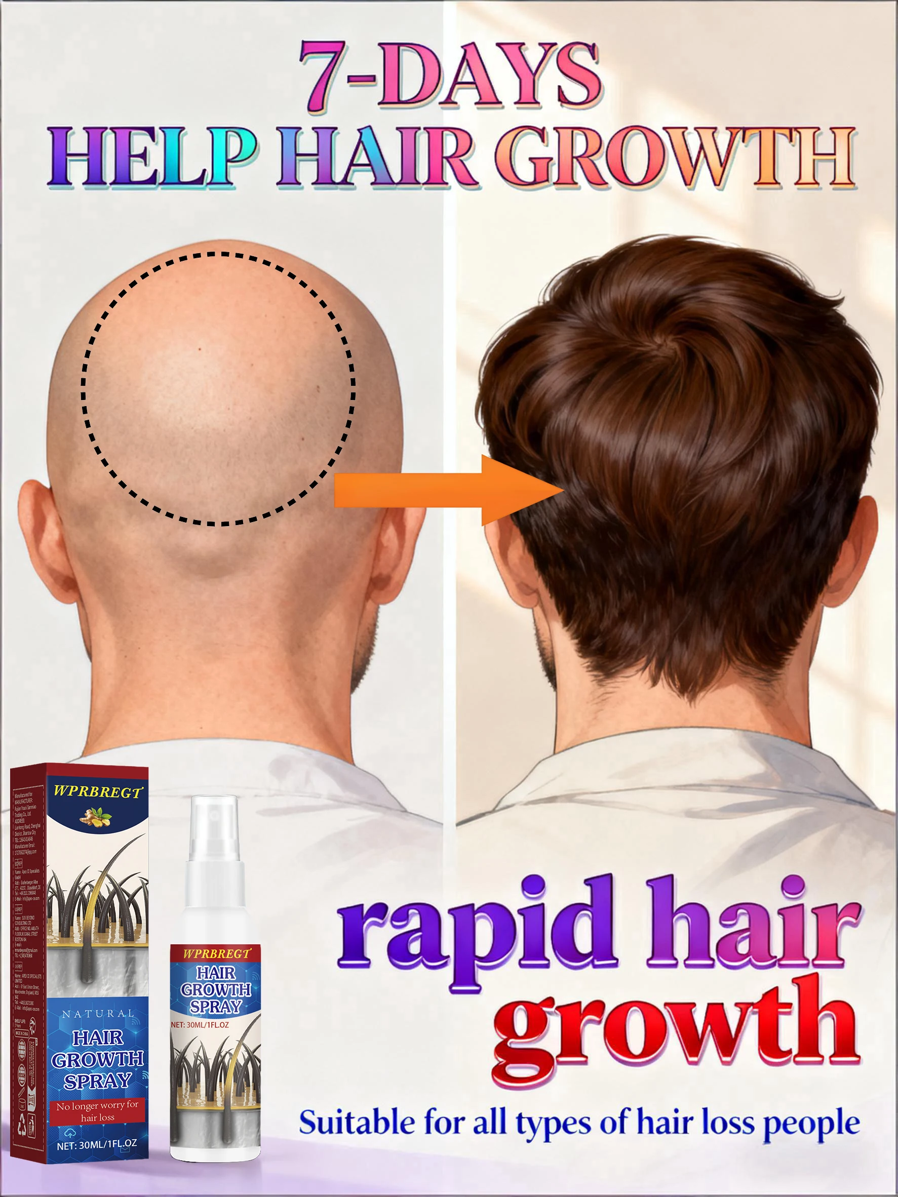 

Bᴀʟᴅɴᴇss ᴡᴏʀʀɪᴇs Hᴀɪʀ ɢʀᴏᴡᴛʜ sᴘʀᴀʏ ᴘʀᴏᴍᴏᴛᴇs ʜᴀɪʀ ɢʀᴏᴡᴛʜ ɪɴ 7 ᴅᴀʏs