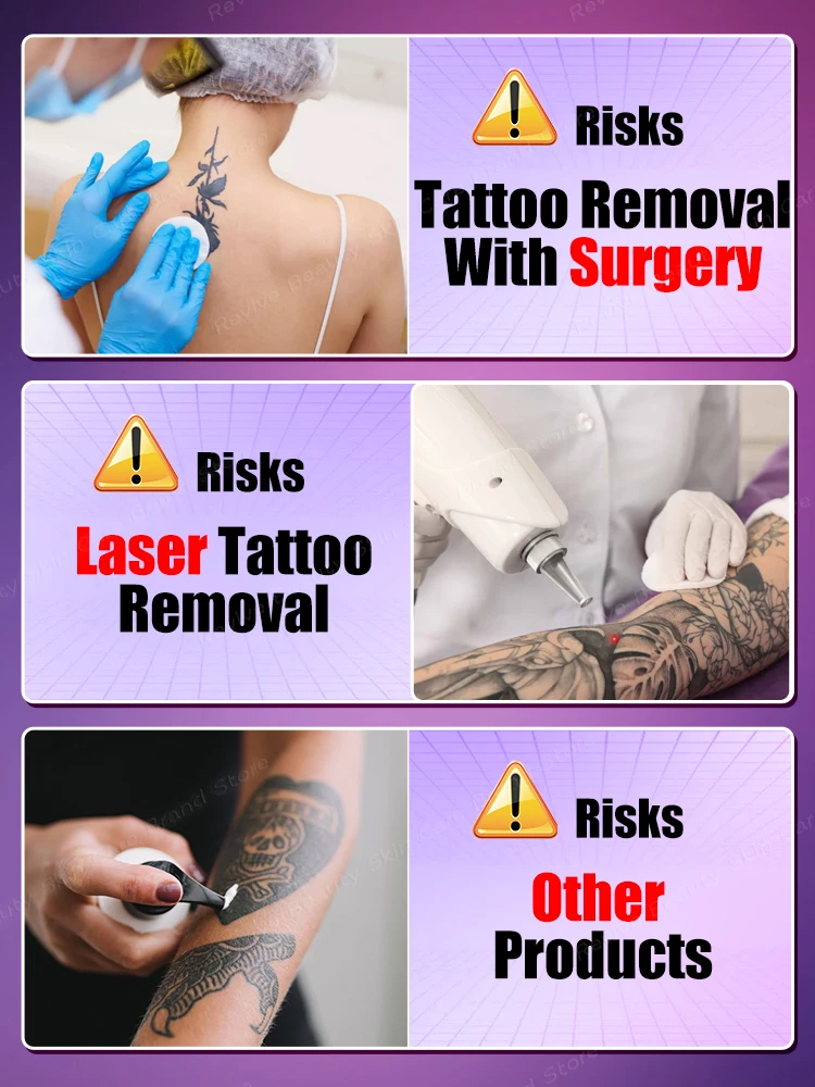 ᵀᵃᵗᵗᵒᵒ ᴿᵉᵐᵒᵛᵃˡ ᔆᵖʳᵃʸ ᔆᵘⁱᵗᵃᵇˡᵉ ᶠᵒʳ ᴸᵃʳᵍᵉ ᵃⁿᵈ ᔆᵐᵃˡˡ ᵀᵃᵗᵗᵒᵒˢ⸴ ᴱᶠᶠᵉᶜᵗⁱᵛᵉ ⁱⁿ ᴿᵉᵐᵒᵛⁱⁿᵍ ᴾᵉʳᵐᵃⁿᵉⁿᵗ ᵀᵃᵗᵗᵒᵒˢ