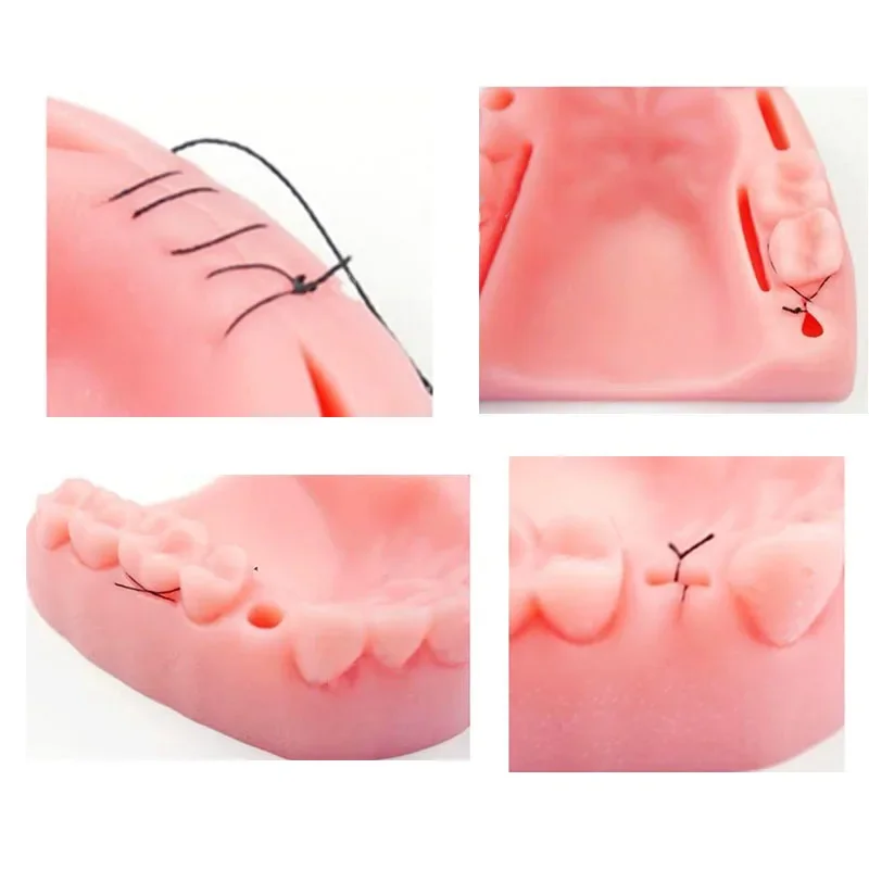 

Dental Suture Training Model Oral Teeth Gum Surgical Practice Kit for Dentist Teaching Wound Simulation XSurgical